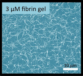 Biopolymeer-netwerken (cellulose en fibrine). Biopolymeer-netwerken (cellulose en fibrine).
