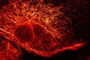 Photograph: Stefan W Hell/Division of Optical Nanoscopy/German Cancer Research Center
